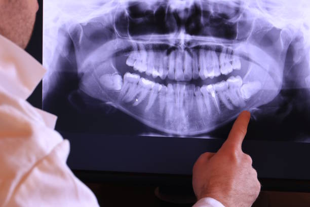 Best Emergency Care for Gum Disease in Redby, MN